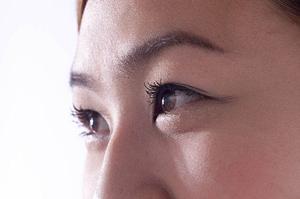 レーザー治療で蒙古斑をなくすクリニック