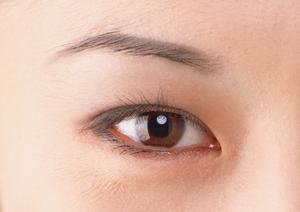 太田母斑を目立たなくするレーザー治療